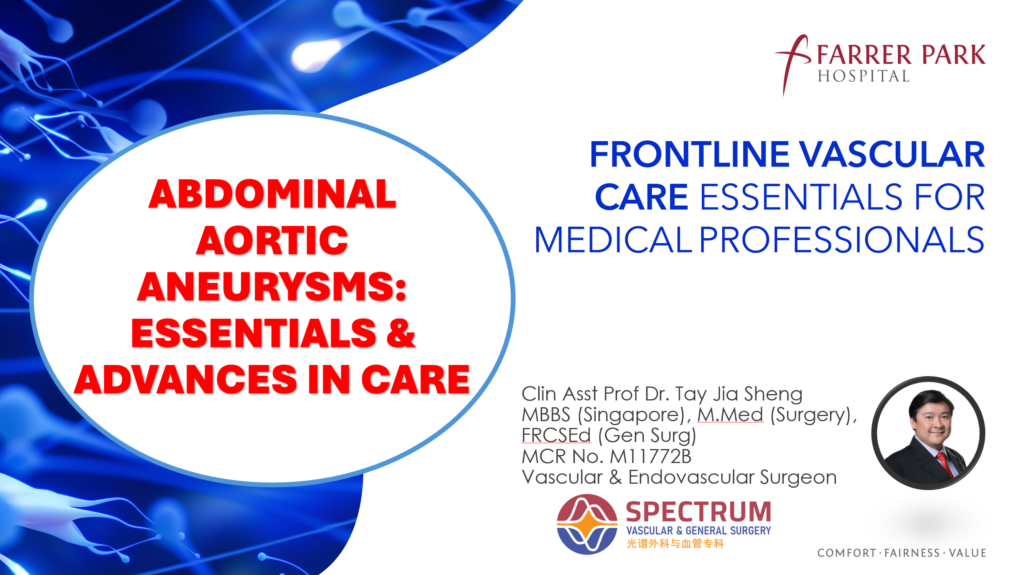 Abdominal Aortic Aneurysms: Essentials & Advances in Care
