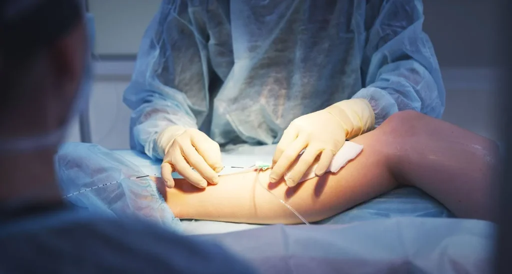 vascular vein surgery | spectrum surgery