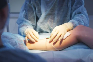 vascular vein surgery | spectrum surgery